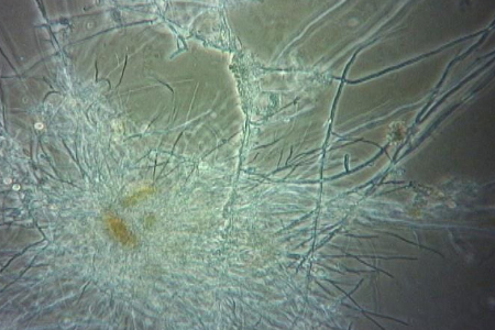 Soil fungus growing through crop residue